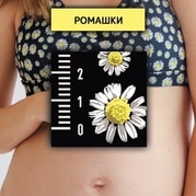 Ромашки